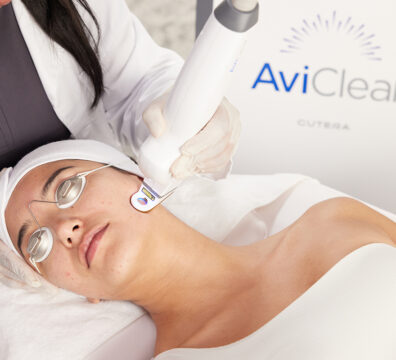 AviClear Treatment 3